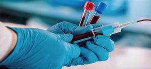Introduction-to-Phlebotomy